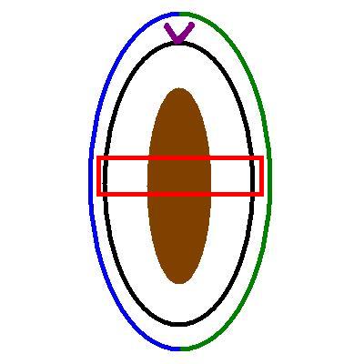 Orientated ellipse of skin
